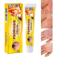 Psoriasis Salbe, Anti Juckreiz Creme, natürliche Feuchtigkeitscreme für die Haut, mit feuchtigkeitsspendender Formel, lindert Rötungen