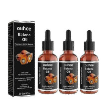 3X Hair Growth Products Contains Rosemary Growing Hair Essential Oil Beauty Hair Care Prevent Hair Loss Oil Scalp Treatment for Men Women