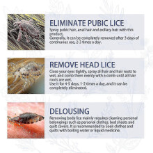 (3PCS) Natural Lice & Scabies Removal Spray - Antibacterial & Anti-Itch Scalp Treatment