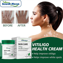 2pcs Vitiligo Cream, Vitiligo Treatment for Skin Vitiligo, Vitiligo Health Cream  35g for Reduce White Spots Improve