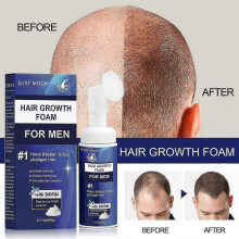 25-26 Regaine for Men Regrowth Scalp Foam