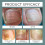 3PCS ProNail Complex Spray Oil for Nail 30ML 3