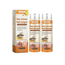 (2pcs) Suitable for Nail Repair Serum, Bee Venom Care Spray, Ingrown Toenail Solution