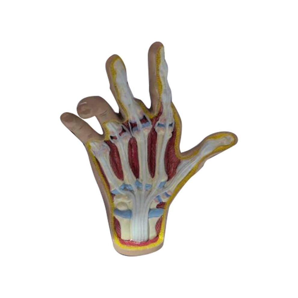 Osteoarthritis Hand Model, Model of Hand Pathology, Human Anatomy and Physiology Replica, Doctor'S Office Anatomy Model