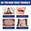 Jaw Adjustment Brace Contains Thermoplastic Elastomer 3