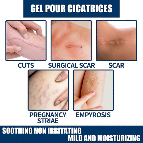 Scar Repair Gel 2