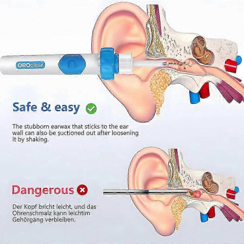 Oroclear Earwax Remover, Electric Ear Cleaner, Oroclear Ear Wax suction Remover 2