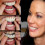 Upper Lower Denture Set Flex Comcompatible witht Fit Cosmetic Teeth Veneer Instant Smile L28 1