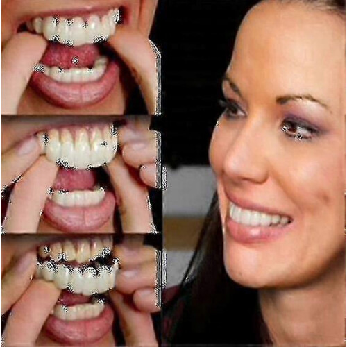 Upper Lower Denture Set Flex Comcompatible witht Fit Cosmetic Teeth Veneer Instant Smile L28