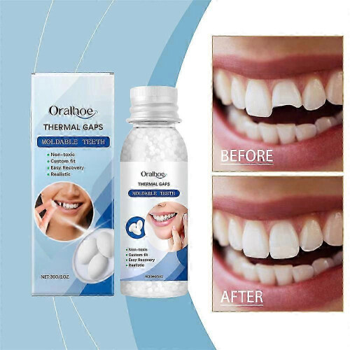 Malleability Solid Dental Glue To Modify Teeth Temporary Hole Filling Glue Denture Glue 1