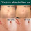 (1 Pcs) Silicone Sheets - Sheets For C-section, Tummy Tuck, Keloid, And Surgical Scars - Reusable Grade Silicone Sheets 4