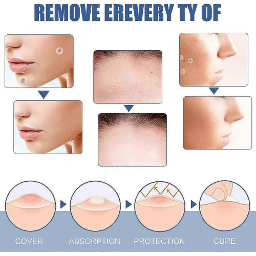 Skin Mole Removal Patches for Gram Wart and Corn Treatment 2