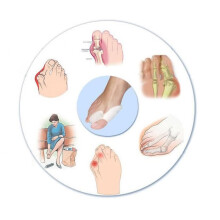 Siliconen hallux valgus-orthese