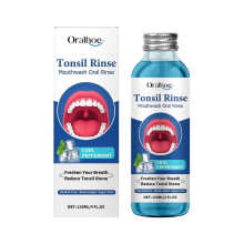(1PC) 1-5x Tonsil Stone Remover, Natural Tonsil Stone Mouthwash, Oral Rinse Liquid for Soothe Tonsils, Bad Breath Treatment and Relief Dry Mouth