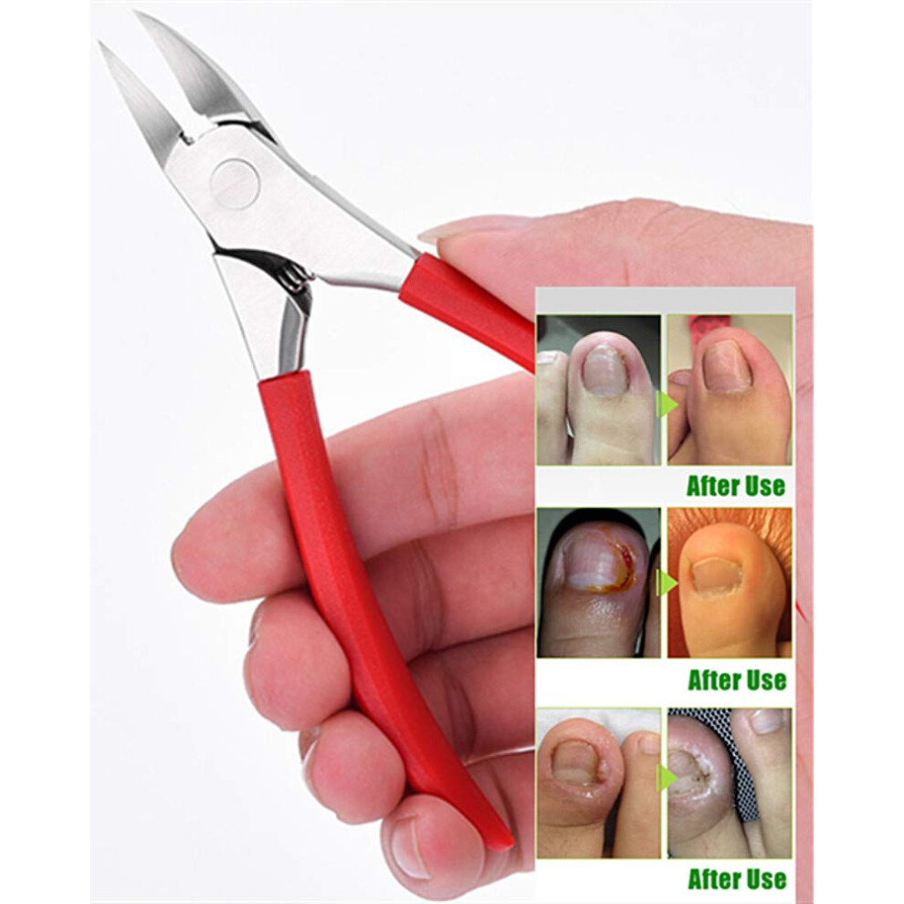 Yeesam Toenail Clippers For Thick Or Ingrown Toenails - Precision Eagle Mouth Long Handle Toe Nail Clippers Scissors For Seniors Professional Trimmer