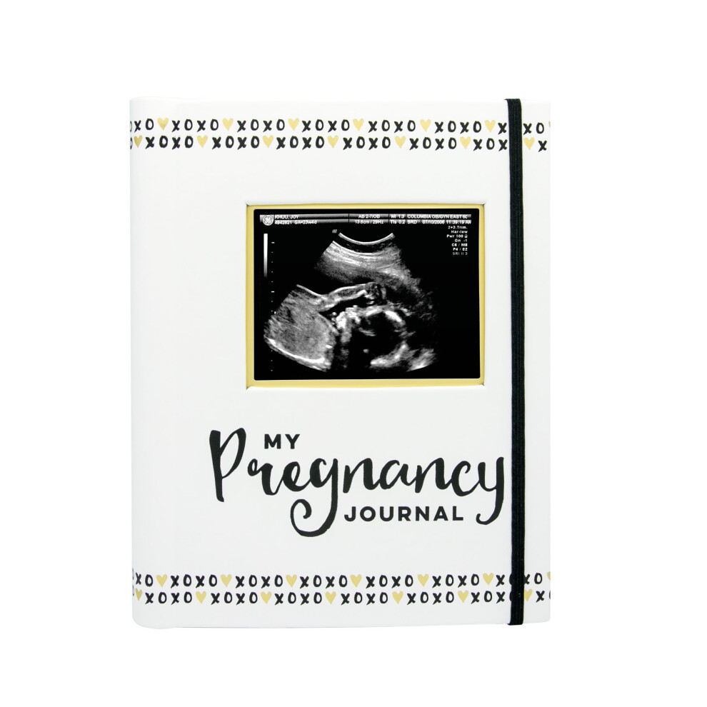 My Pregnancy Journal, Pregnancy Keepsake Book, Pregnancy Milestone Memories And Photo Album, Gender Neutral For Baby Girl Or Baby Boy Pearhead