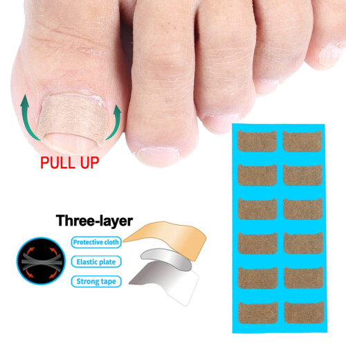 Patchs correcteurs d'ongles incarnés – TPU, 120 pièces