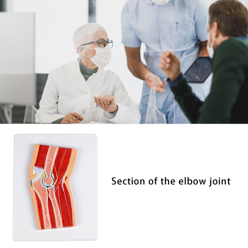 Sectional Elbow Joint Anatomy Model For Clinical Training 1
