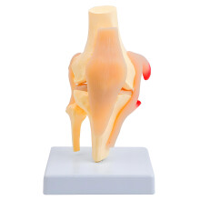 Professional PVC Anatomical Patella Knee Joint Model For Patient