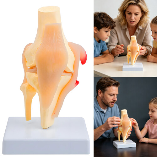 Anatomical Knee Joint Structure Model PVC Patella Knee Joint 1