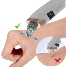 Electric Blackhead Extractor Skin Care Instrument 16.5Cm