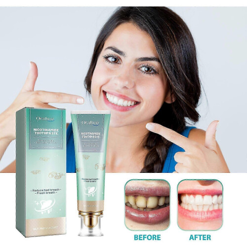2025 Toothpaste White Toothpaste Fresh Breath Breat Removal Dazzling White Toothpaste 100g 1