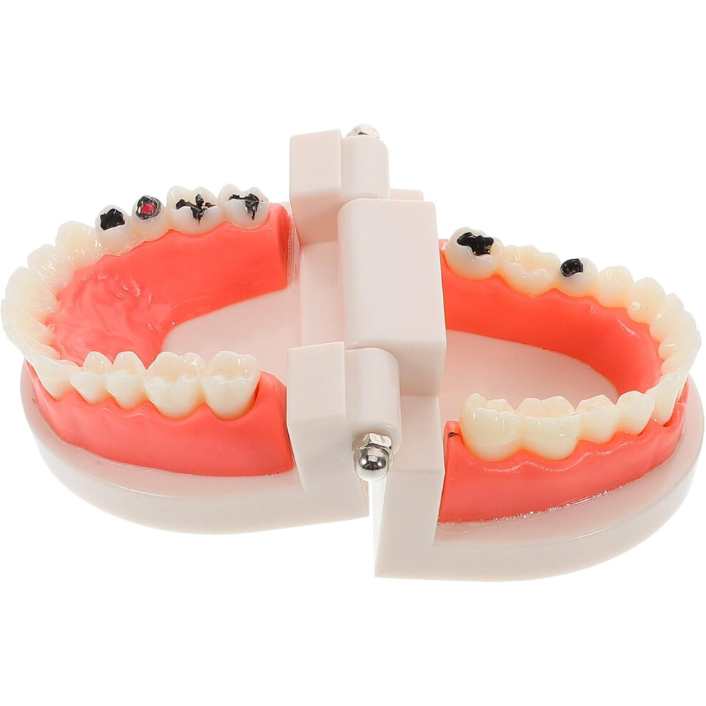 Hkhbjs Denture Models Realistic Dentist Standard Teeth Model For Study And Teaching Flesh