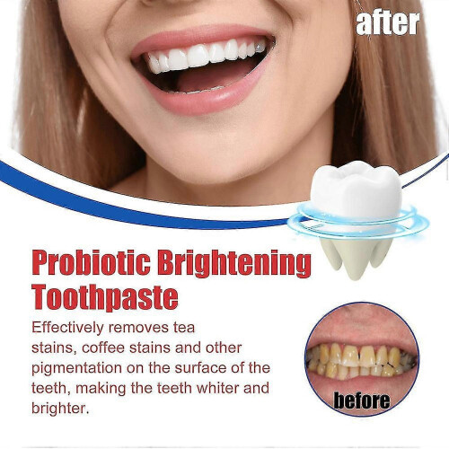 (1pc) 120g Sp-6 Probiotics Brightening White Toothpaste Toot 1