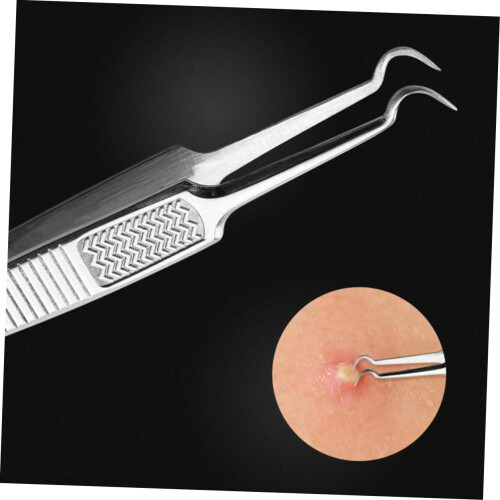 Pince à épiler en acier inoxydable pour points noirs, 3 pièces 1