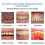 Probiotic Tooth Gel with Tea Polyphenols 2