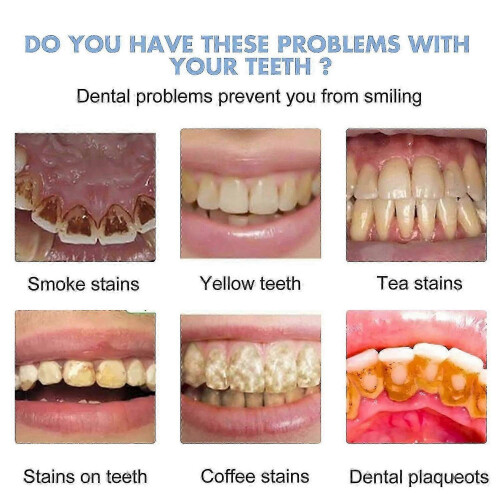 Probiotic Tooth Gel with Tea Polyphenols 1