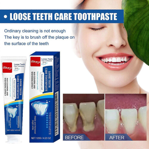 Toothpaste fresh breath anti-caries teeth cleaning teeth stains bright white 1