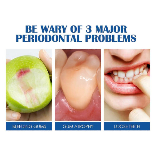Toothpaste fresh breath anti-caries teeth cleaning teeth stains bright white 2