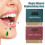 (Red) 4pcs Mint Mineral Supplement Chewing Gum 4