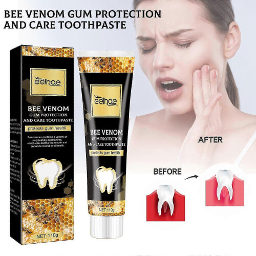 Teeth Whitening Toothpaste for Fresh Breath and Stain Cleaning 1