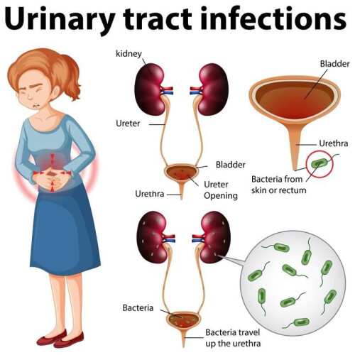 5 Pack - Urinary Tract Infection Urine Test Strips Tests 4 Key UTI Indicators, Leukocytes, Nitrites, Protein & Blood 2