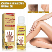 Brightening & Exfoliating Acanthosis Nigricans Removal Oil with Jojoba Oil  Gentle Skin Lightening, Moisturizing, and Targeted Dark Area Treatment for