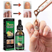 Ginger Nail Treatment Grey Nail Repair Hand & Foot Nail Care Moisturizer Soft & Bright Nail