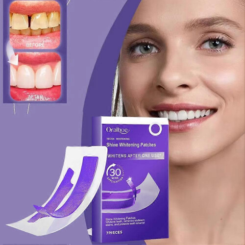 Purple Teeth Shine Whitening Strips-7Pcs/Box 1