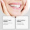 Instant Smile Enhancement Kit  Comfortable Resin Denture & Brace Modifications 4