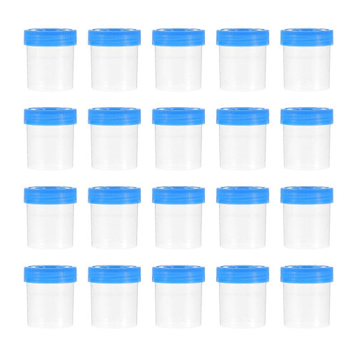 30 Pcs Sterile Urine Sample Specimen Cups with Lids for Laboratory Test Collection