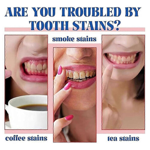 (1pcs) SP6 Probiotics Whitening Toothpaste Removing Bad Odor Toothpaste for Teeth Care 2