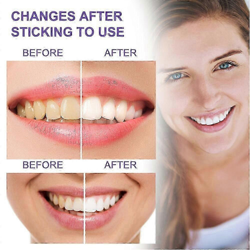 30ml Tooth Whitening Toothpaste Refreshing Breath Toothpaste for Hotel Bathroom 1