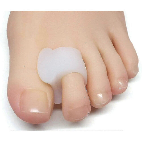 8pcs Toe Separator for Overlapping Toes, Bunions, Big Toe Alignment, Braces And Spacers