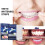 Whitening teeth strips, care for teeth, remove stains, whiten teeth, clean teeth strips 1