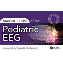 Making Sense of the Pediatric EEG Paperback Book
