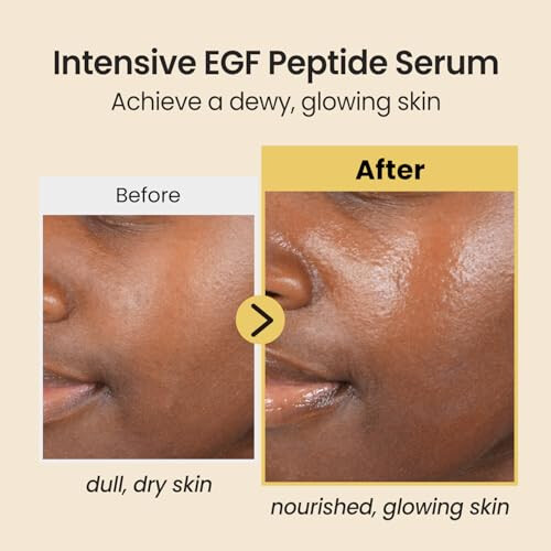 Coxir Intensive EGF Peptide Serum, 1 x 50 ml 2