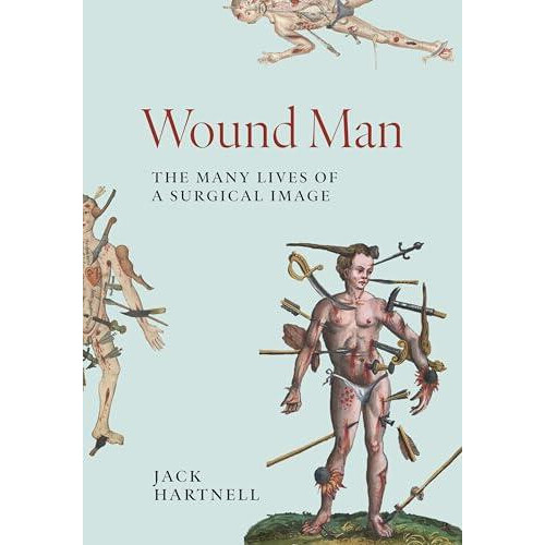 Wound Man by Jack Hartnell Hardcover Book