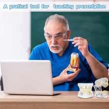 Disease Teeth Model Dental Typodonts Implant Teeth Model with Removable Teeth Dentist Standard Tooth Demonstration