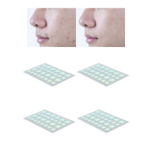 Hydrocolloid-Patch gegen Pickel in Sternform 58 Stück